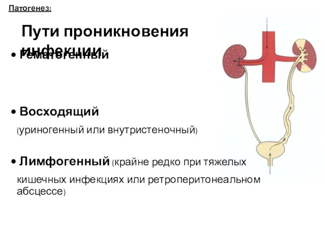 Патогенез: Пути проникновения инфекции Гематогенный Восходящий (уриногенный или внутристеночный) Лимфогенный (крайне редко