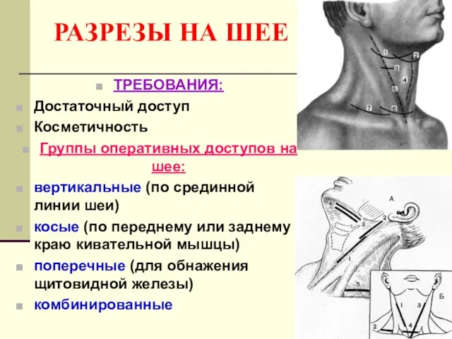 РАЗРЕЗЫ НА ШЕЕ ТРЕБОВАНИЯ: Достаточный доступ Косметичность Группы оперативных доступов на шее: