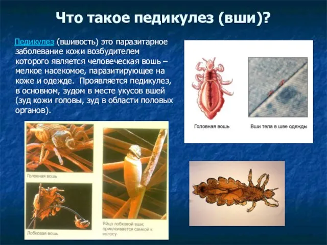 Что такое педикулез (вши)? Педикулез (вшивость) это паразитарное заболевание кожи возбудителем которого