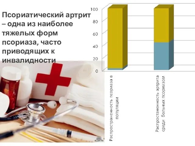 Псориатический артрит – одна из наиболее тяжелых форм псориаза, часто приводящих к инвалидности