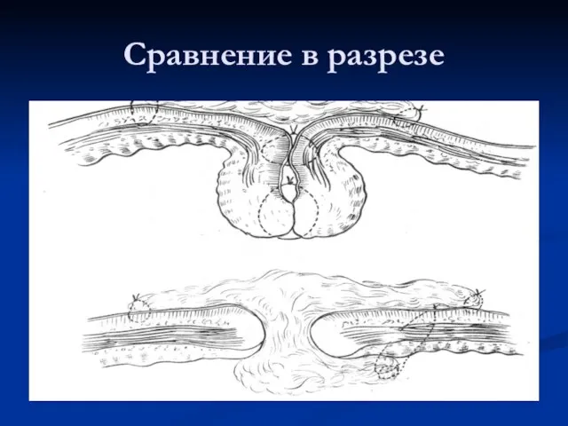 Сравнение в разрезе