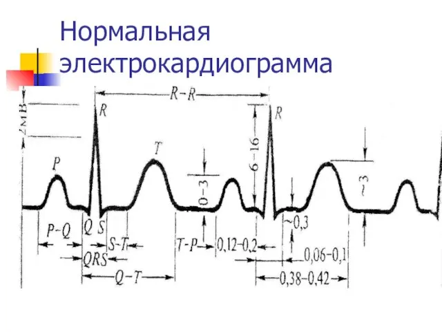 Нормальная электрокардиограмма