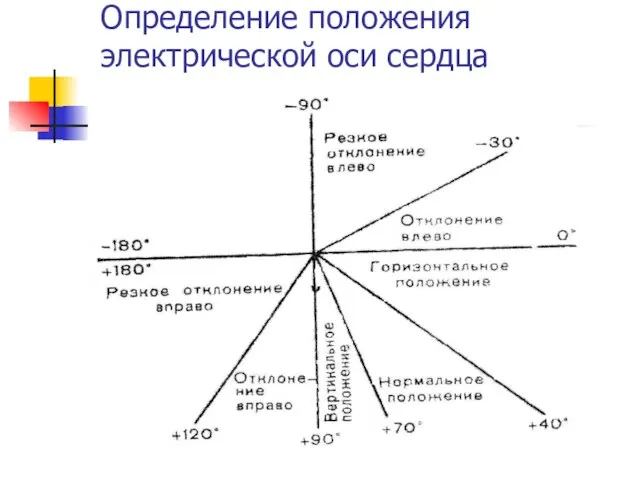 Определение положения электрической оси сердца