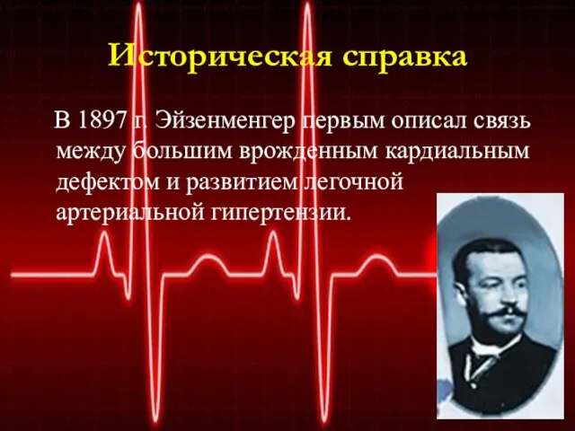 Историческая справка В 1897 г. Эйзенменгер первым описал связь между большим врожденным