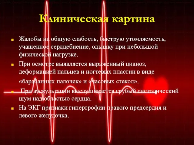 Клиническая картина Жалобы на общую слабость, быструю утомляемость, учащенное сердцебиение, одышку при