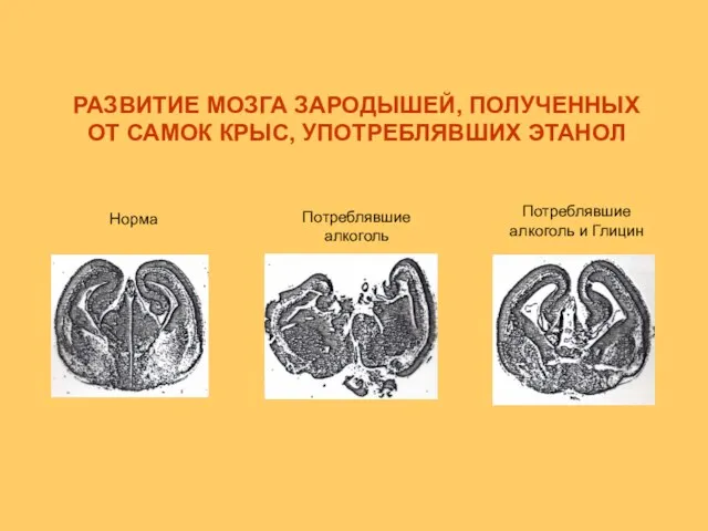 РАЗВИТИЕ МОЗГА ЗАРОДЫШЕЙ, ПОЛУЧЕННЫХ ОТ САМОК КРЫС, УПОТРЕБЛЯВШИХ ЭТАНОЛ Норма Потреблявшие алкоголь Потреблявшие алкоголь и Глицин