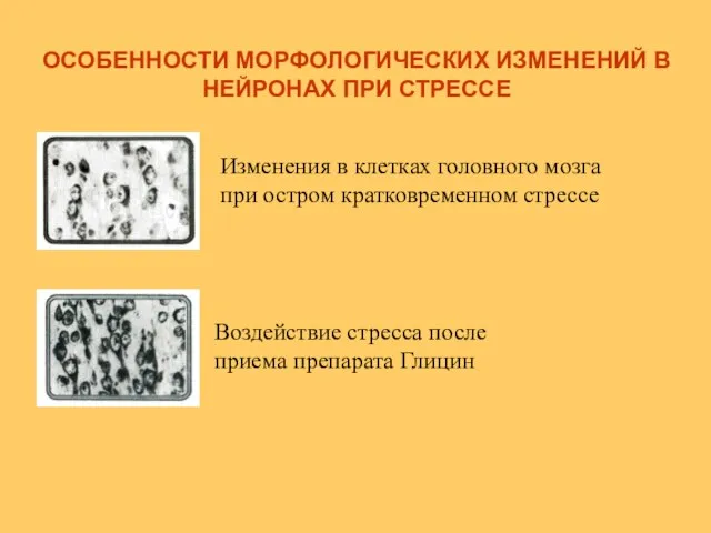 ОСОБЕННОСТИ МОРФОЛОГИЧЕСКИХ ИЗМЕНЕНИЙ В НЕЙРОНАХ ПРИ СТРЕССЕ Воздействие стресса после приема препарата