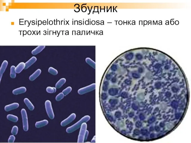 Збудник Erysipelothrix insidiosa – тонка пряма або трохи зігнута паличка