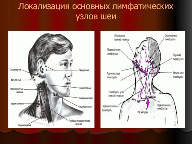 Локализация основных лимфатических узлов шеи