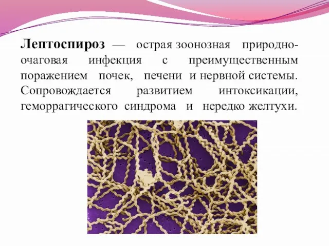 Лептоспироз — острая зоонозная природно-очаговая инфекция с преимущественным поражением почек, печени и