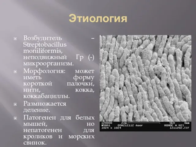 Этиология Возбудитель – Streptobacillus moniliformis, неподвижный Гр (-) микроорганизм. Морфология: может иметь