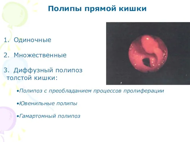 Полипы прямой кишки Одиночные Множественные Диффузный полипоз толстой кишки: Полипоз с преобладанием