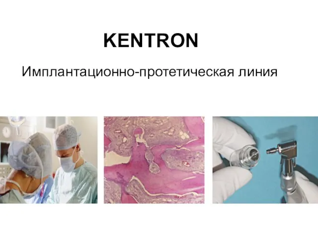 Имплантационно-протетическая линия KENTRON