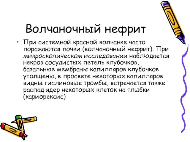 Волчаночный нефрит При системной красной волчанке часто поражаются почки (волчаночный нефрит). При