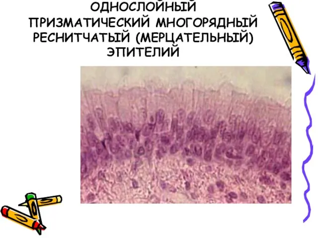 ОДНОСЛОЙНЫЙ ПРИЗМАТИЧЕСКИЙ МНОГОРЯДНЫЙ РЕСНИТЧАТЫЙ (МЕРЦАТЕЛЬНЫЙ) ЭПИТЕЛИЙ