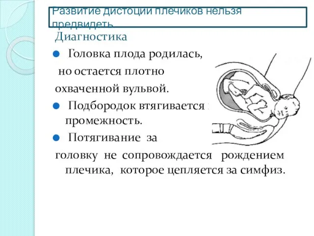 Развитие дистоции плечиков нельзя предвидеть. Диагностика Головка плода родилась, но остается плотно