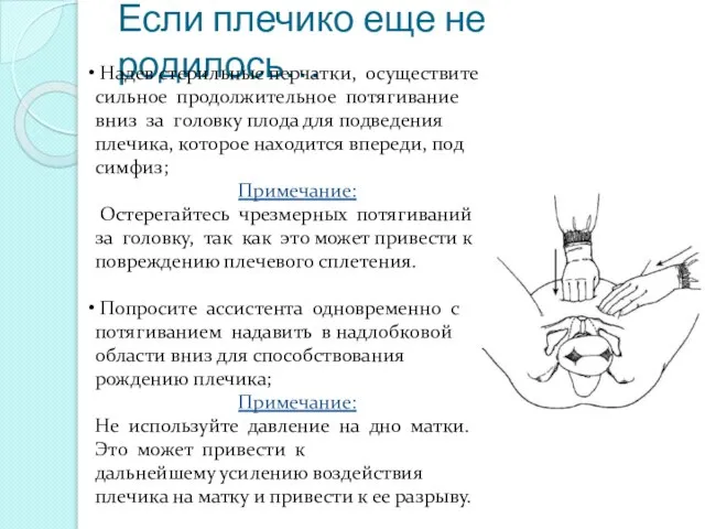 Если плечико еще не родилось… Надев стерильные перчатки, осуществите сильное продолжительное потягивание