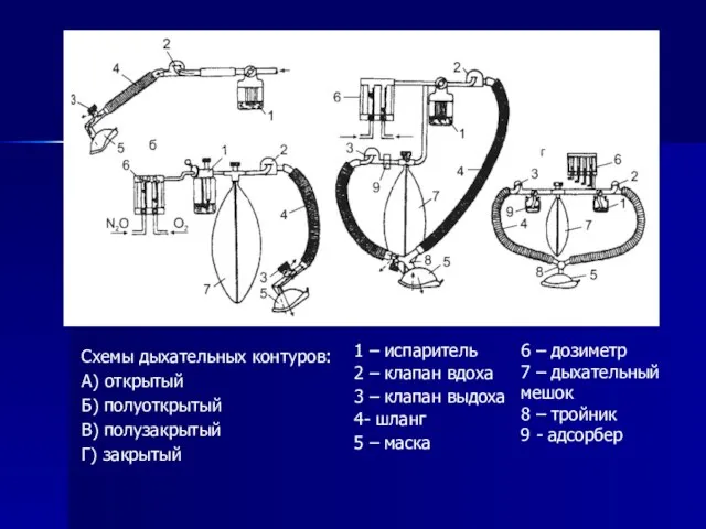 Схемы дыхательных контуров: А) открытый Б) полуоткрытый В) полузакрытый Г) закрытый 1