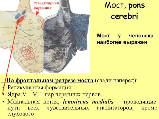 Мост, pons cerebri На фронтальном разрезе моста (сзади наперед): Ретикулярная формация Ядра