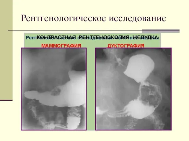 Рентгенологическое исследование КОНТРАСТНАЯ РЕНТГЕНОСКОПИЯ ЖЕЛУДКА