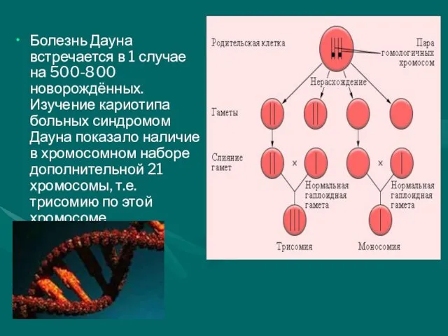 Болезнь Дауна встречается в 1 случае на 500-800 новорождённых. Изучение кариотипа больных