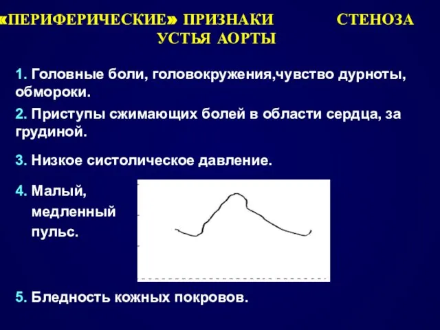 «ПЕРИФЕРИЧЕСКИЕ» ПРИЗНАКИ СТЕНОЗА УСТЬЯ АОРТЫ