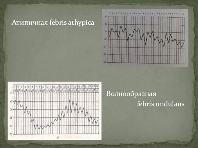 Атипичная febris athypica Волнообразная febris undulans