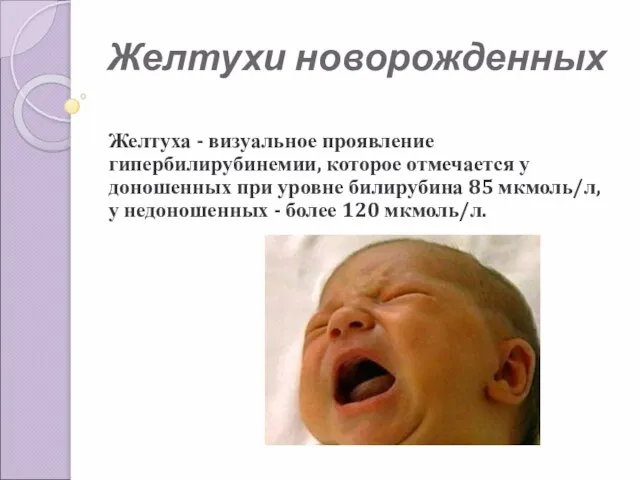 Желтухи новорожденных Желтуха - визуальное проявление гипербилирубинемии, которое отмечается у доношенных при