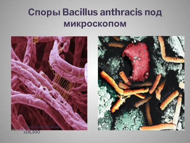Споры Вacillus anthracis под микроскопом Споры увеличение x18,300