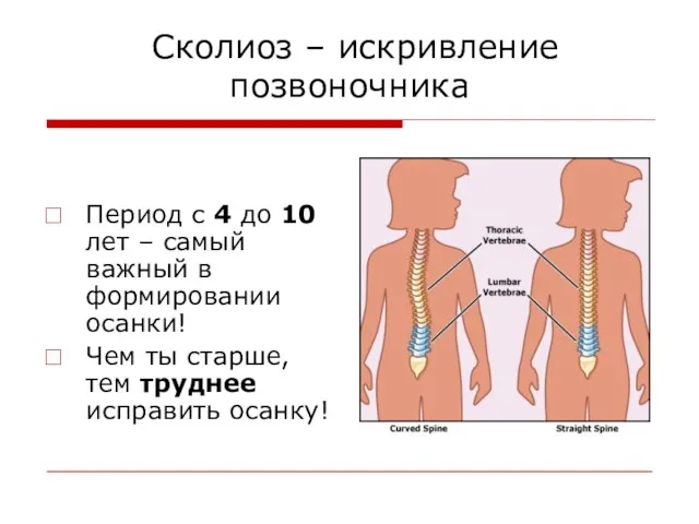 Сколиоз – искривление позвоночника Период с 4 до 10 лет – самый