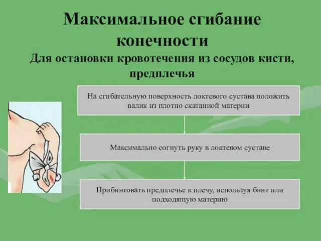 Максимальное сгибание конечности Для остановки кровотечения из сосудов кисти, предплечья На сгибательную