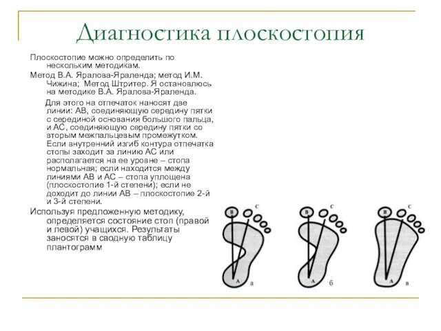 Диагностика плоскостопия Плоскостопие можно определить по нескольким методикам. Метод В.А. Яралова-Яраленда; метод