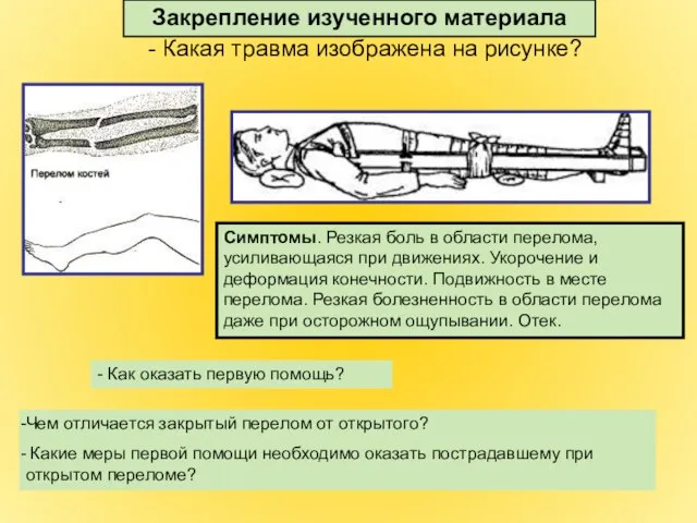 - Какая травма изображена на рисунке? Чем отличается закрытый перелом от открытого?