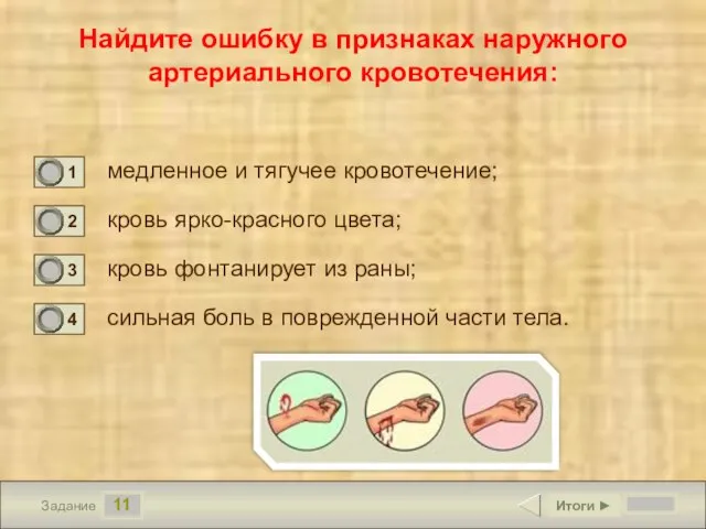 11 Задание Найдите ошибку в признаках наружного артериального кровотечения: медленное и тягучее