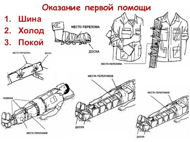 Оказание первой помощи Шина Холод Покой