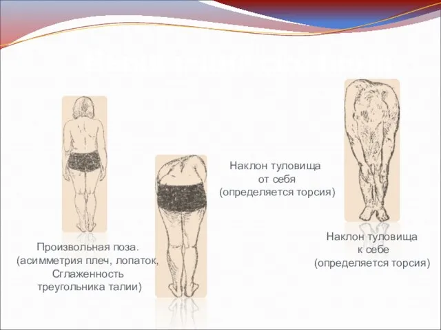 Произвольная поза. (асимметрия плеч, лопаток, Сглаженность треугольника талии) Наклон туловища от себя