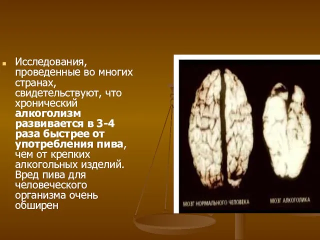 Исследования, проведенные во многих странах, свидетельствуют, что хронический алкоголизм развивается в 3-4