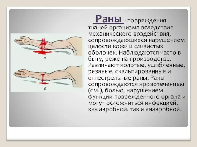 Раны - повреждения тканей организма вследствие механического воздействия, сопровождающиеся нарушением целости кожи