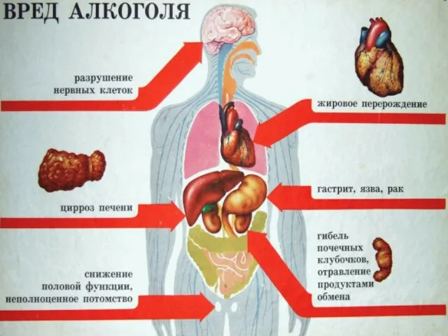 Багмут А. , ученица 9а Алкоголь. Его отрицательное влияние.