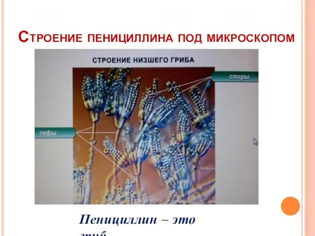 Строение пенициллина под микроскопом Пенициллин – это гриб.