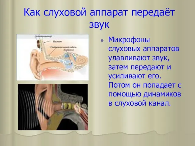 Как слуховой аппарат передаёт звук Микрофоны слуховых аппаратов улавливают звук, затем передают