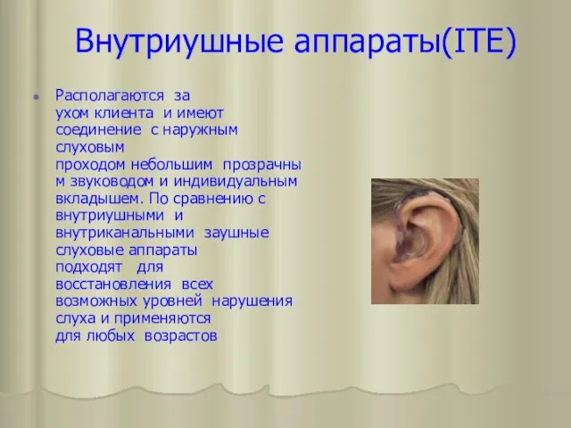 Внутриушные аппараты(ITE) Располагаются за ухом клиента и имеют соединение с наружным слуховым