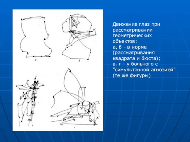 Движение глаз при рассматривании геометрических объектов: а, б - в норме (рассматривания
