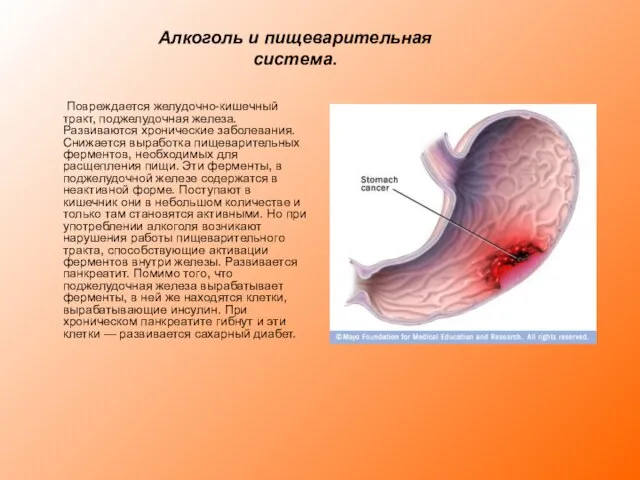 Алкоголь и пищеварительная система. Повреждается желудочно-кишечный тракт, поджелудочная железа. Развиваются хронические заболевания.