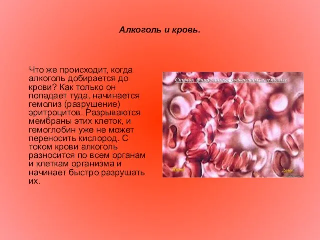 Алкоголь и кровь. Что же происходит, когда алкоголь добирается до крови? Как