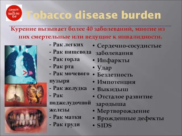 Курение вызывает более 40 заболеваний, многие из них смертельные или ведущие к