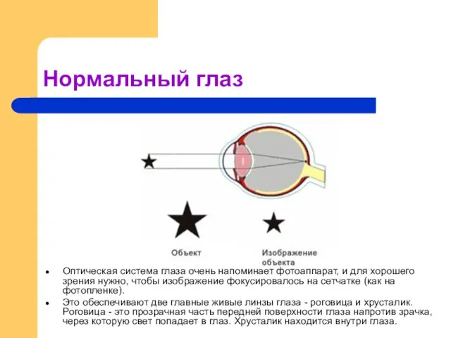 Нормальный глаз Оптическая система глаза очень напоминает фотоаппарат, и для хорошего зрения