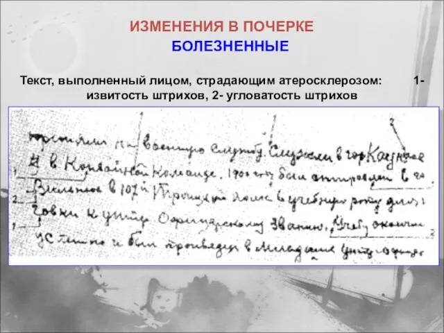 Текст, выполненный лицом, страдающим атеросклерозом: 1-извитость штрихов, 2- угловатость штрихов ИЗМЕНЕНИЯ В ПОЧЕРКЕ БОЛЕЗНЕННЫЕ