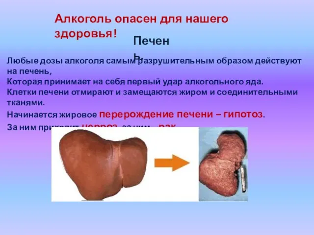 Алкоголь опасен для нашего здоровья! Печень. Любые дозы алкоголя самым разрушительным образом