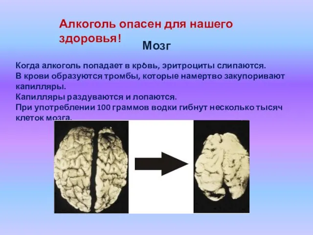 Алкоголь опасен для нашего здоровья! Мозг. Когда алкоголь попадает в кровь, эритроциты